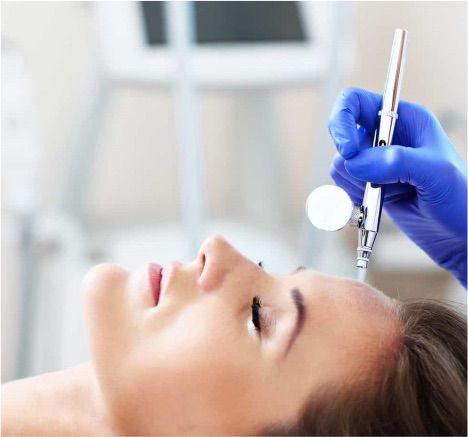Rezultat tratament facial 6