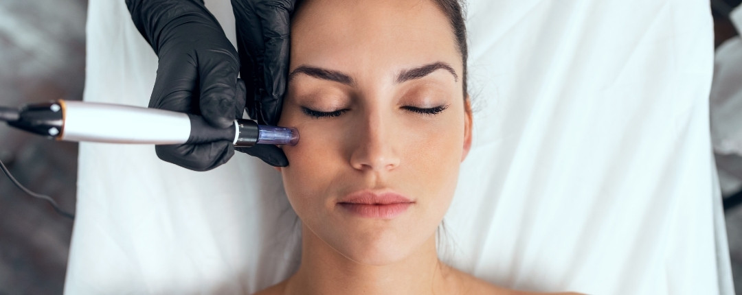 Microneedling piele
