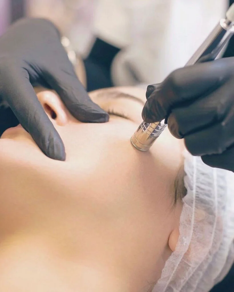 Microneedling Dermapen The Lash Lounge